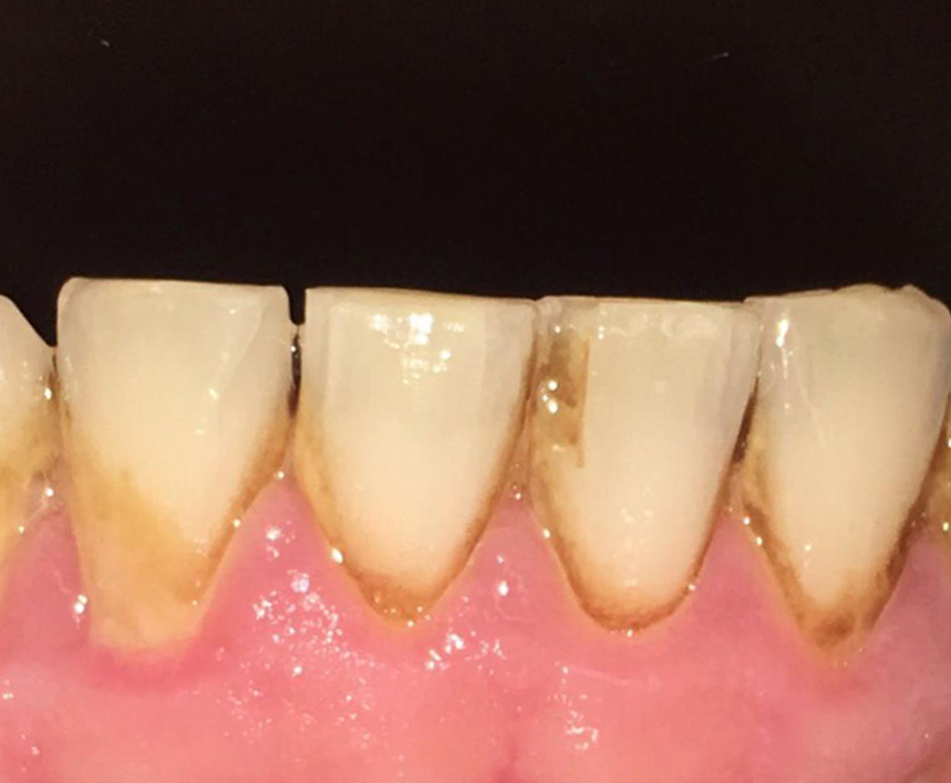 stain removal northern ireland